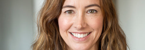 How to Treat Rosy skin Naturally Without Antibiotics