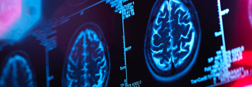 The Gut-Brain Connection: What Your Microbiome Is Doing to Your Mental Health