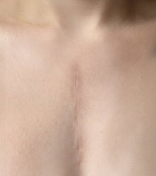 After image
