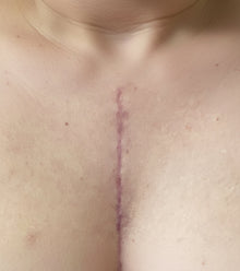 Before image