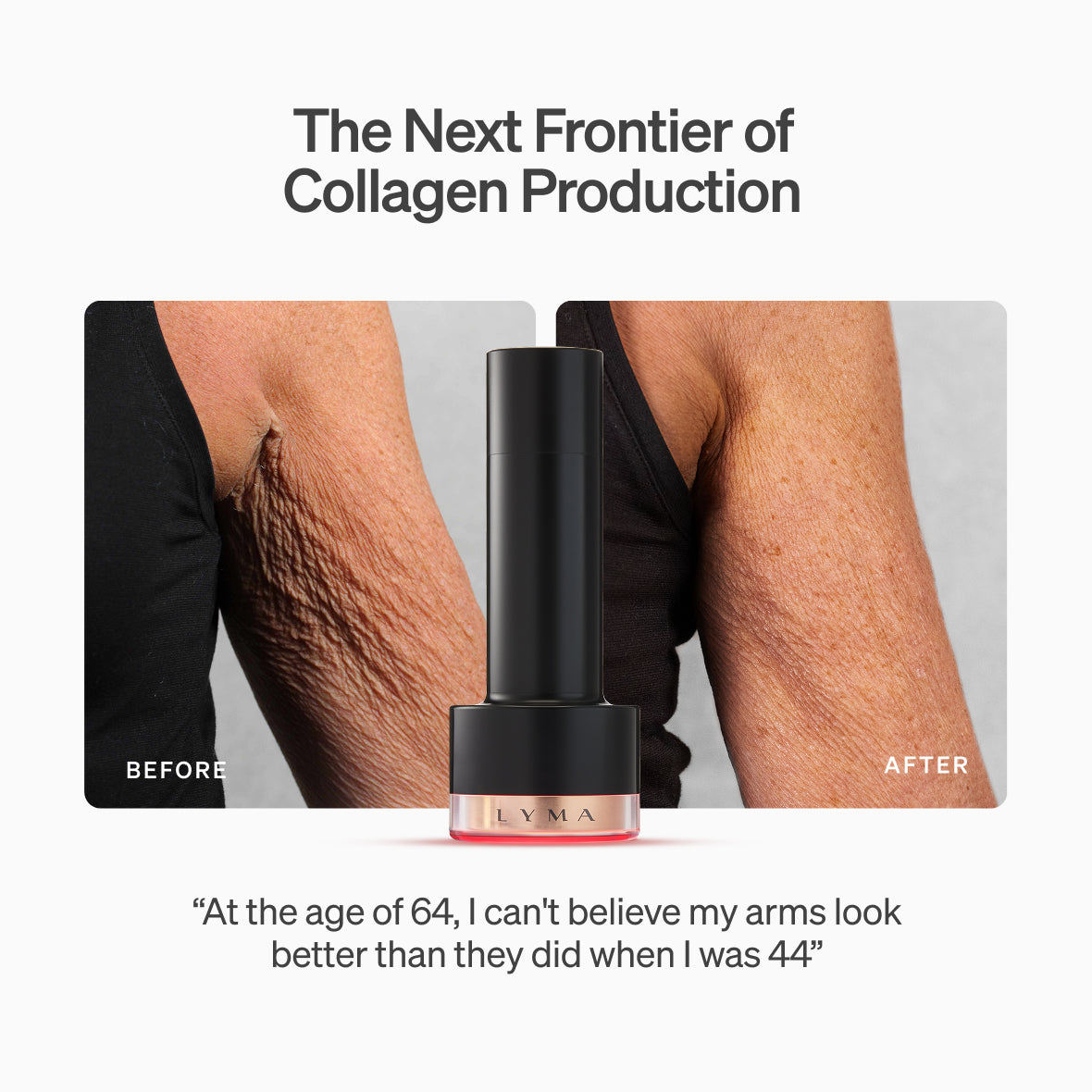 The LYMA Laser PRO - LYMA's breakthrough cold laser technology. Younger skin. Bigger lens. Faster results.