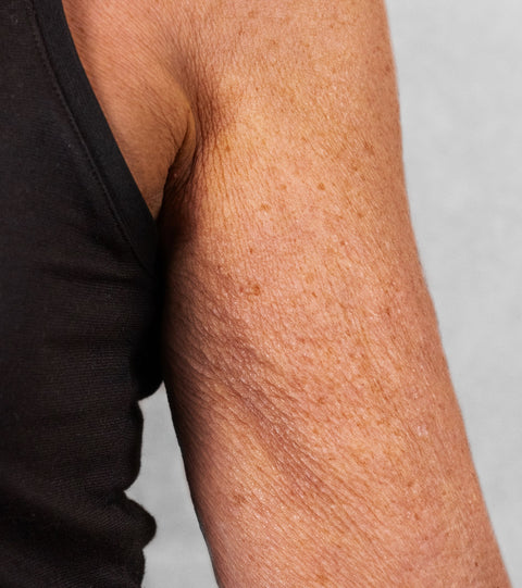 The LYMA Laser PRO - LYMA's breakthrough cold laser technology. Younger skin. Bigger lens. Faster results.