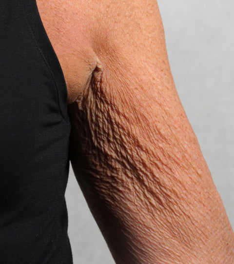 The LYMA Laser PRO - LYMA's breakthrough cold laser technology. Younger skin. Bigger lens. Faster results.