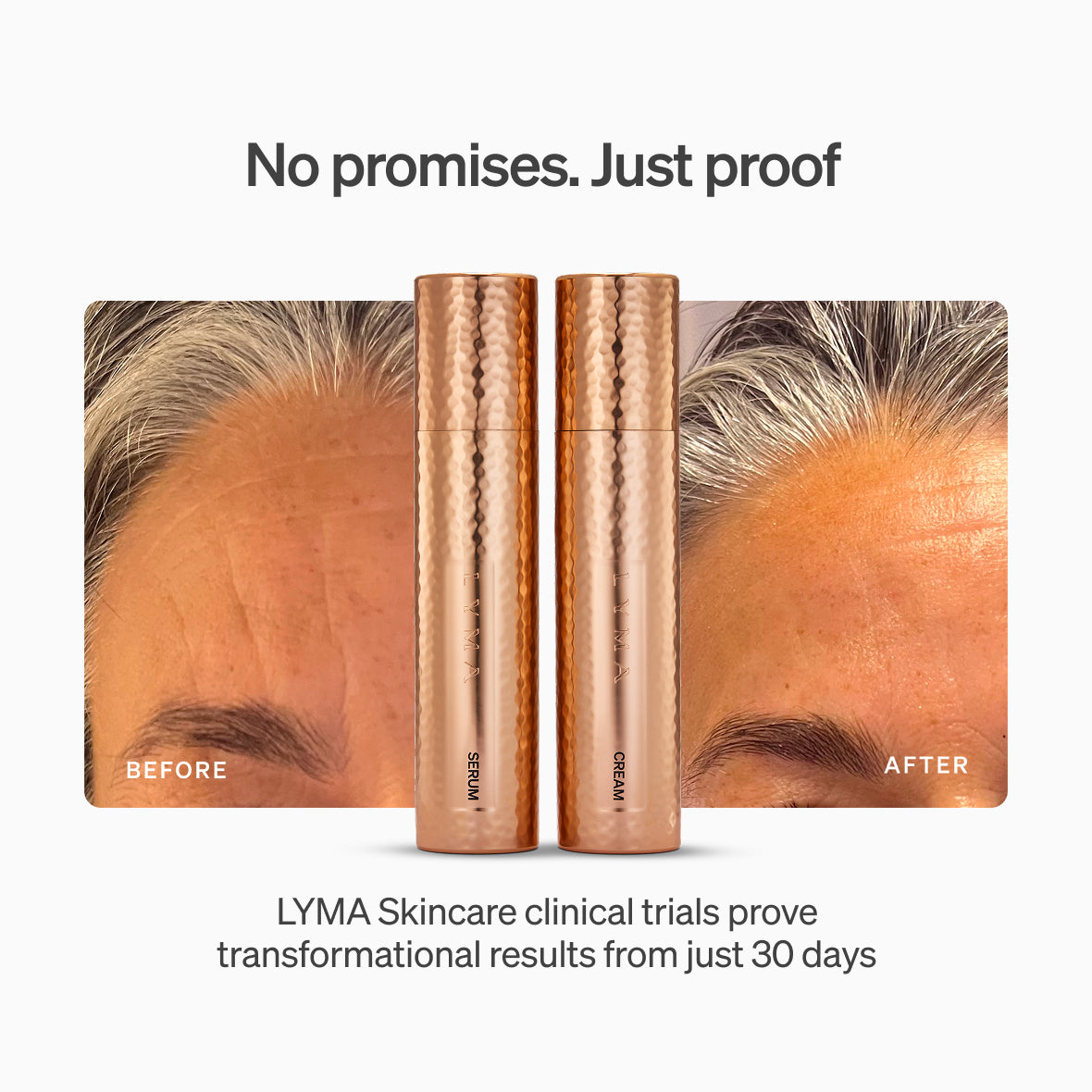 The LYMA PRO Youth System - Tighter jawline. Fewer wrinkles. Firmer neck. This is what happens when three technologies are engineered as one anti-aging system.
