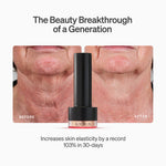 The LYMA PRO Youth System - Tighter jawline. Fewer wrinkles. Firmer neck. This is what happens when three technologies are engineered as one anti-aging system.