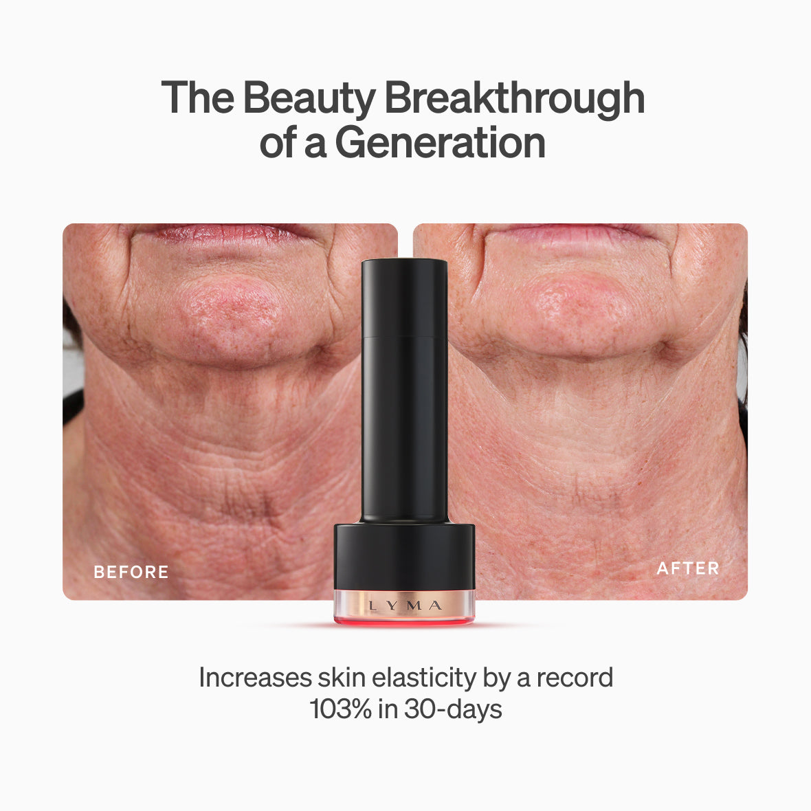 The LYMA PRO Youth System - Tighter jawline. Fewer wrinkles. Firmer neck. This is what happens when three technologies are engineered as one anti-aging system.