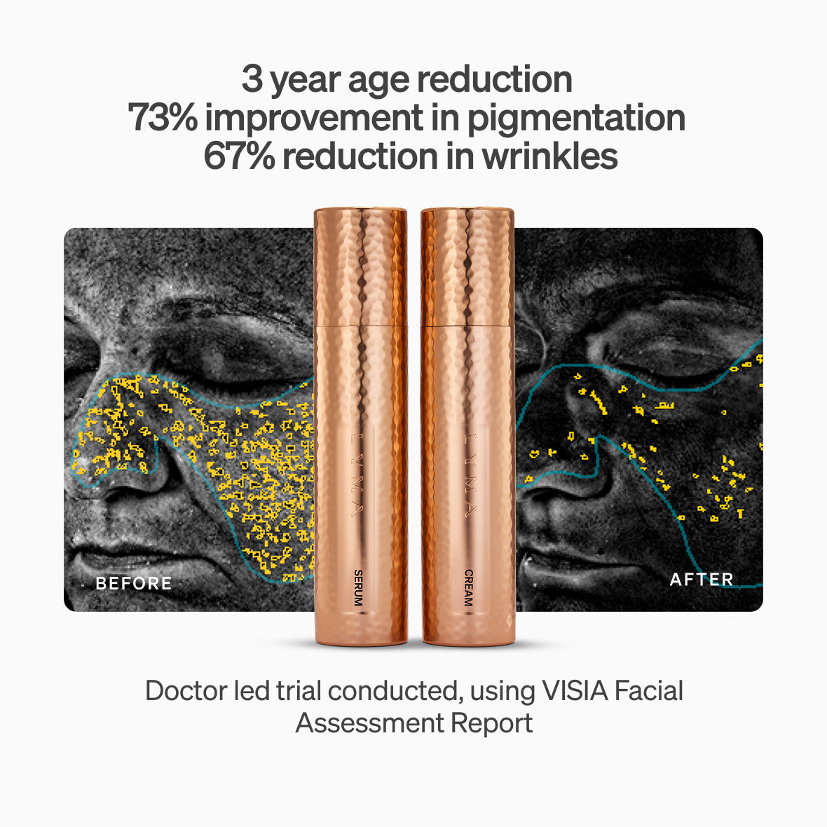 The LYMA PRO Youth System - Tighter jawline. Fewer wrinkles. Firmer neck. This is what happens when three technologies are engineered as one anti-aging system.