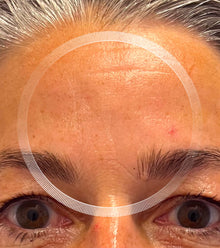 After image