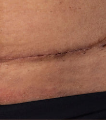 Before image