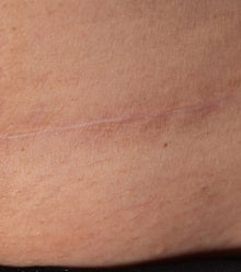 After image