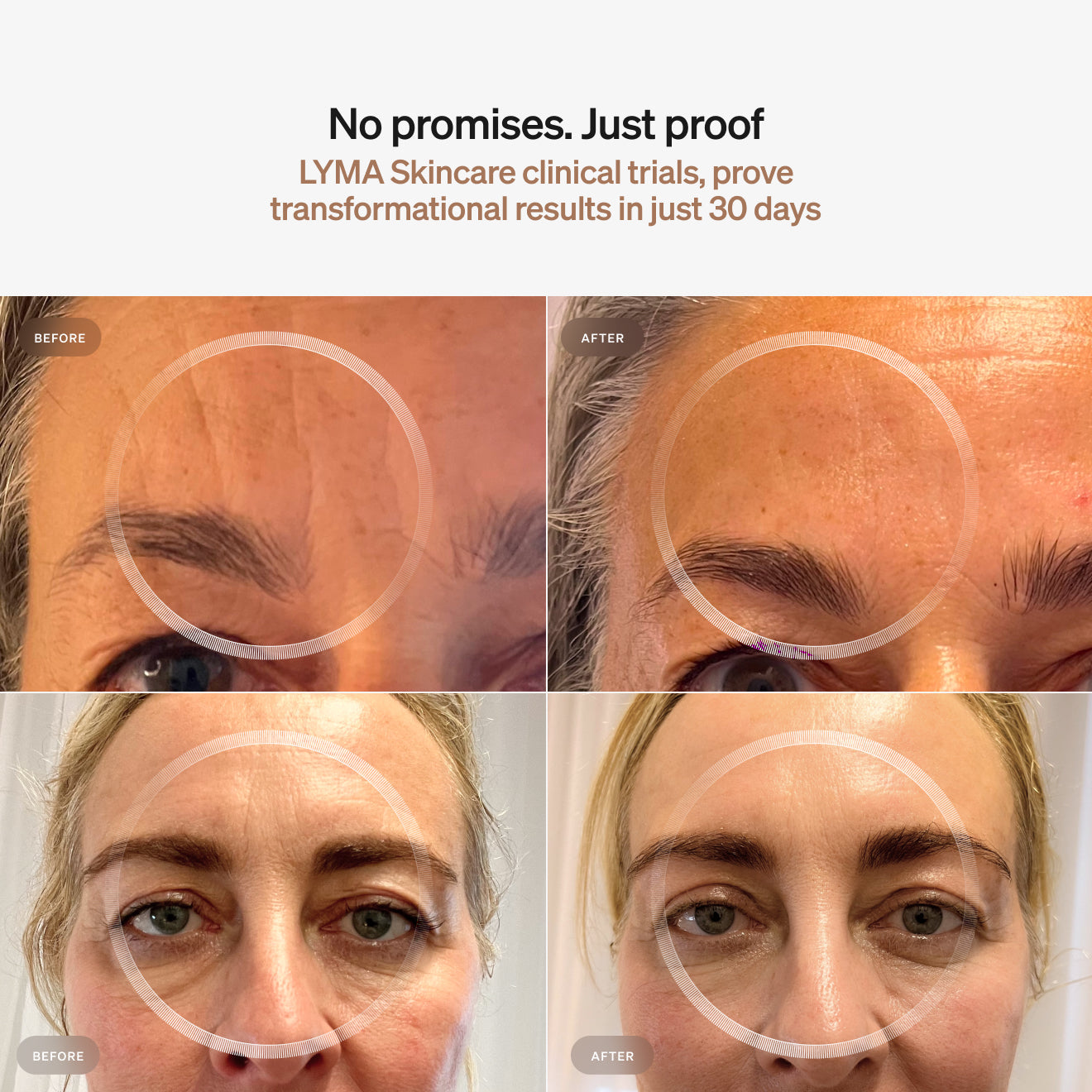 LYMA Skincare Refill - Replenish your refillable LYMA Skincare Bottles. These are the ultimate anti-ageing formulations. Most active, anti-aging formulations in existence.